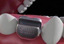 Зуб для открывания бутылок Зуб для открывания бутылок - Stone Forest