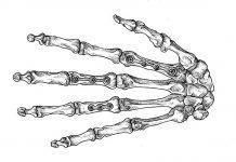 Конструкции в травматологии Что такое остеосинтез - Stone Forest