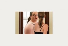 Дисморфофобия – что это и как появляется? Дисморфофобия