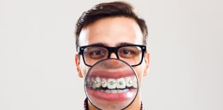 Как правильно чистить зубы с брекетами Как чистить зубы с брекетами