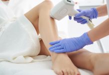 Лазерная эпиляция: история создания, принципы проведения Что такое лазерная эпиляция