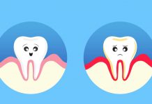 Почему кровоточат десны и как справиться с этой проблемой Почему кровоточат десны