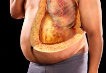 Куда девать лишние килограммы, или какую ценность несет в себе человеческий жир Человеческий жир