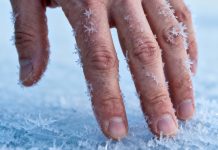 9 вещей, которые ухудшают состояние кожи зимой Состояние кожи зимой