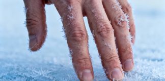 9 вещей, которые ухудшают состояние кожи зимой Состояние кожи зимой