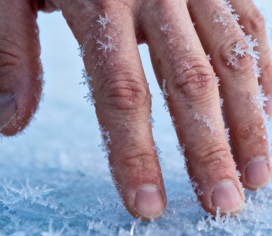 9 вещей, которые ухудшают состояние кожи зимой Состояние кожи зимой