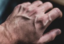 Искусственный интеллект в дерматологии: диагностика, прогнозирование и персонализация Искусственный интеллект в дерматологии