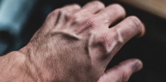 Искусственный интеллект в дерматологии: диагностика, прогнозирование и персонализация Искусственный интеллект в дерматологии