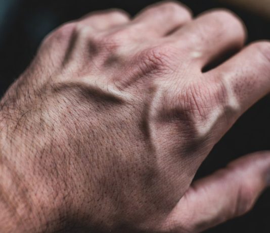 Искусственный интеллект в дерматологии: диагностика, прогнозирование и персонализация Искусственный интеллект в дерматологии