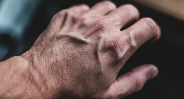 silnaja-muzhskaja-ruka-1 Искусственный интеллект в дерматологии