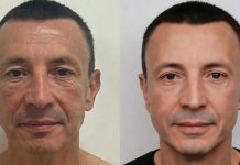 Окушко Ситора рассказала, что изменилось за последние годы в мужской пластической хирургии Почему мужчины стали чаще обращаться к пластическим хирургам