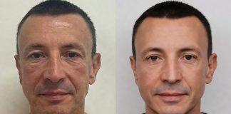 Окушко Ситора рассказала, что изменилось за последние годы в мужской пластической хирургии Почему мужчины стали чаще обращаться к пластическим хирургам