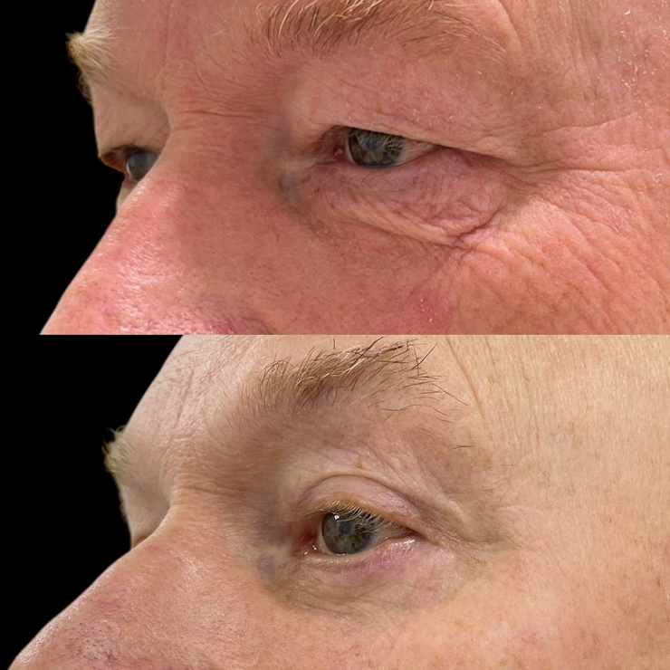 Почему мужчины стали чаще обращаться к пластическим хирургам