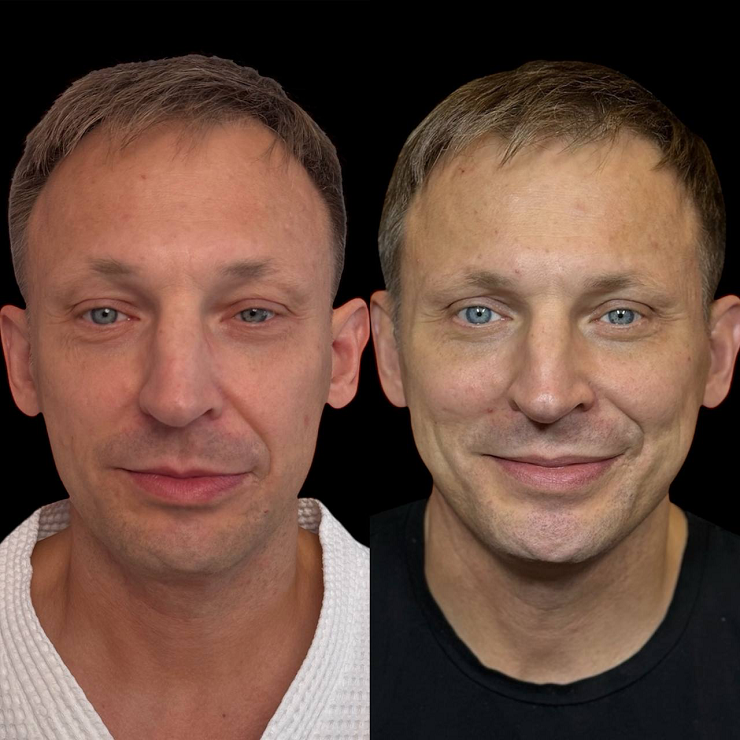 Почему мужчины стали чаще обращаться к пластическим хирургам