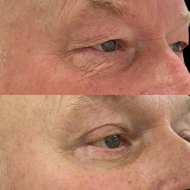 Почему мужчины стали чаще обращаться к пластическим хирургам