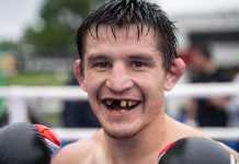 Скрытые последствия ударов: почему боксёрам нужен регулярный стоматологический контроль Почему боксёрам нужен регулярный стоматологический контроль