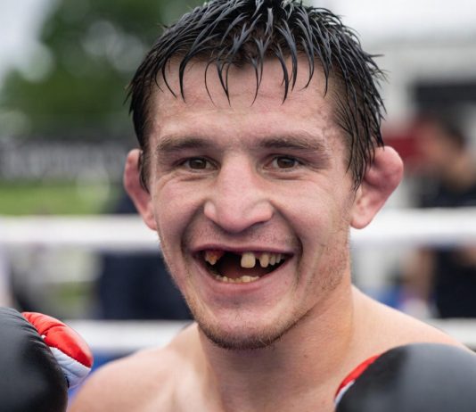 Скрытые последствия ударов: почему боксёрам нужен регулярный стоматологический контроль Почему боксёрам нужен регулярный стоматологический контроль