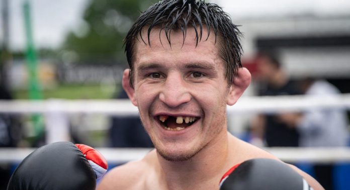 Почему боксёрам нужен регулярный стоматологический контроль